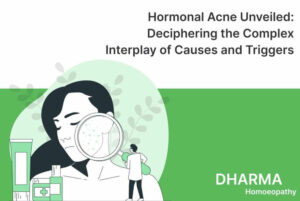 Read more about the article Hormonal Acne Unveiled: Deciphering the Complex Interplay of Causes and Triggers
