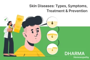Read more about the article Skin Diseases: Types, Symptoms, Treatment & Prevention